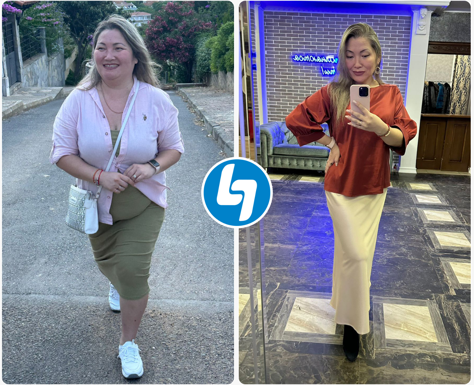 Gastric bypass surgery